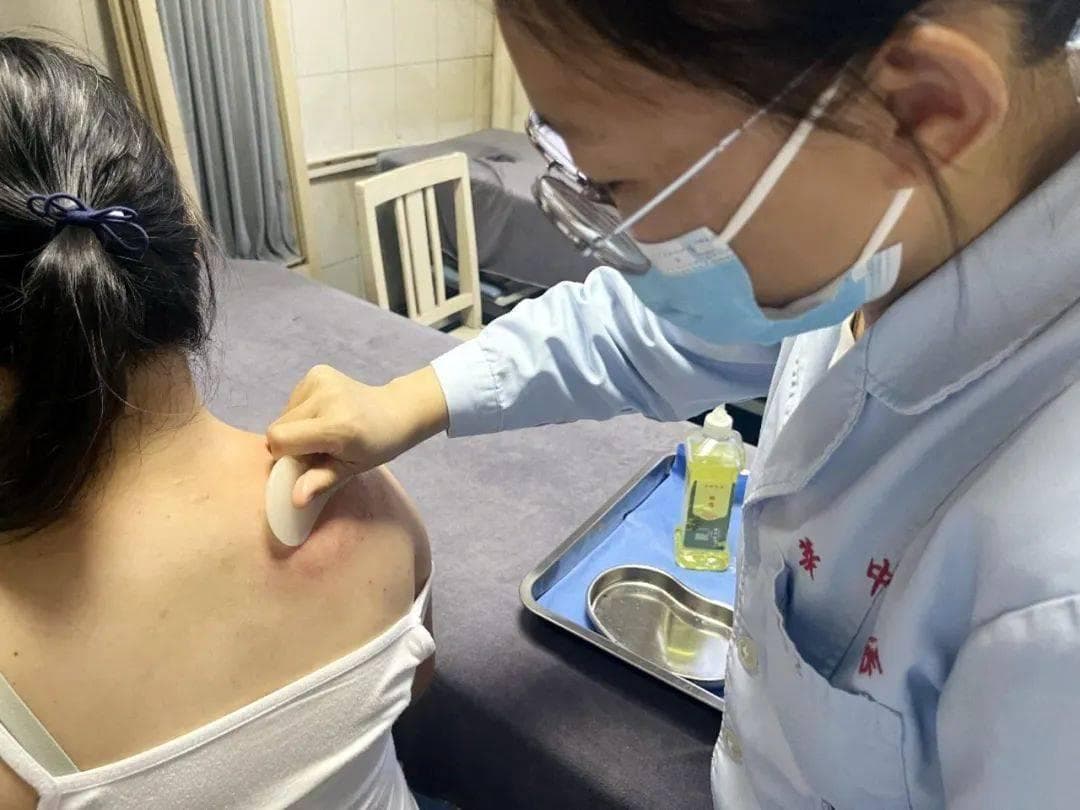 科普| 关于刮痧，中医护士分享的常识