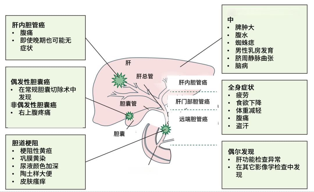 预后差、发病率不断上升，不容忽视的小众肿瘤——胆道系统肿瘤