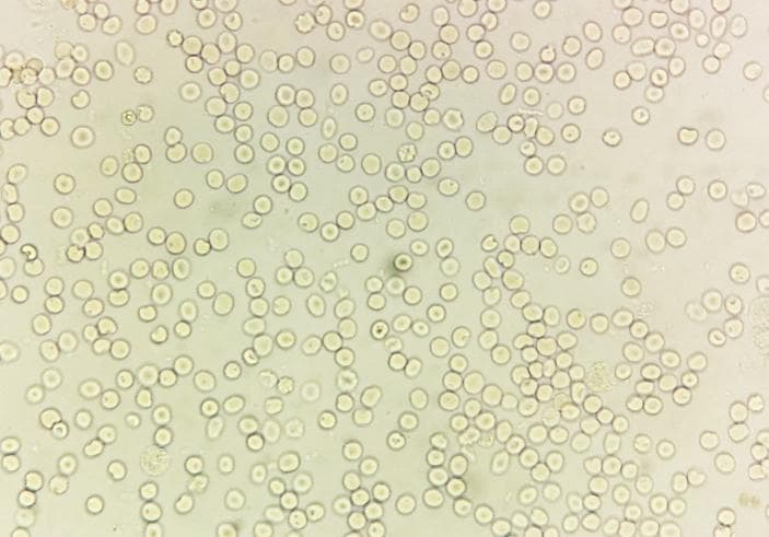 尿液中 11 种红细胞的形态与临床意义