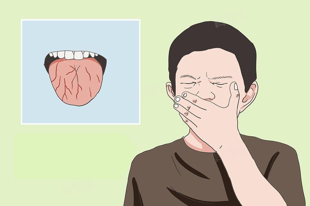 舌头中间裂开了是怎么回事