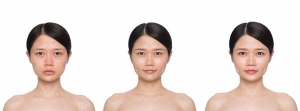 面部轮廓不对称是怎么回事