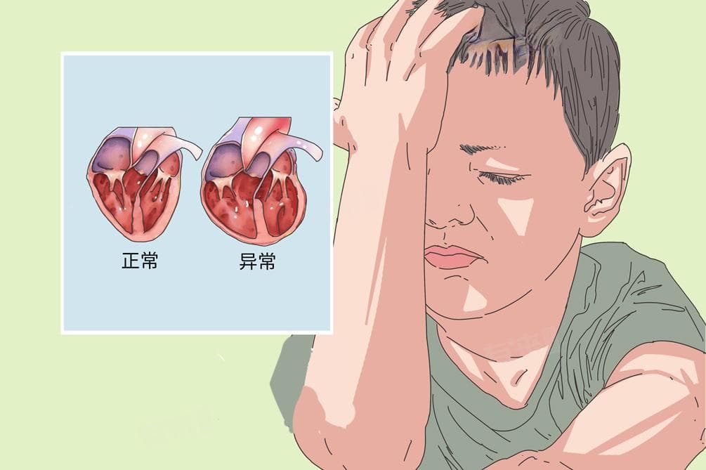 心肌致密化不全这个病严重吗