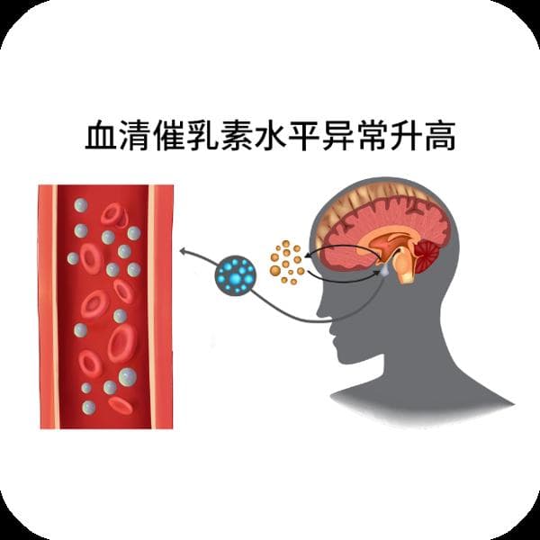 皮质醇高如何调理