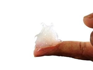 医用硅酮凝胶敷料可以去痘印吗