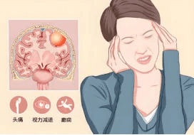 脑膜瘤揭秘：颅内“不速之客”