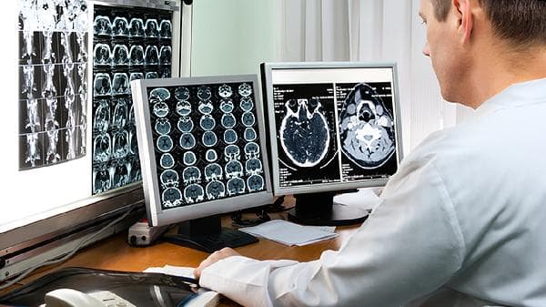 老人摔倒后脑出血的症状、治疗与预防