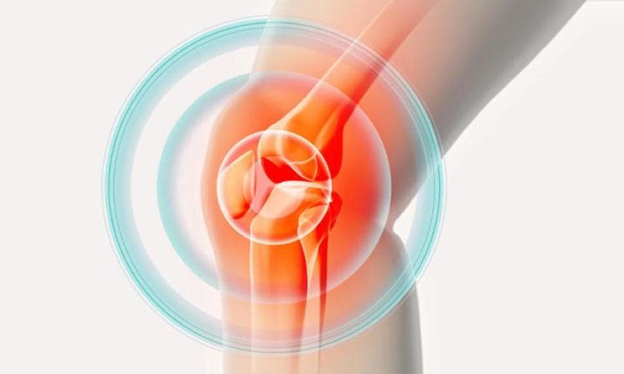 膝盖的呼救信号：深入探索髌骨软化症的早期迹象
