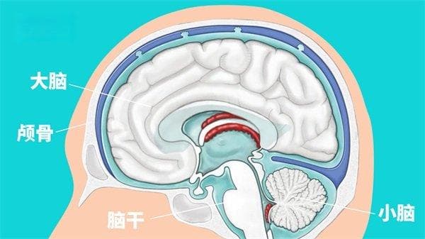 囊性动脉瘤：定义、症状、诊断与治疗全解析