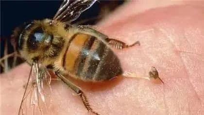 被蜜蜂、马蜂蜇伤怎么办？6大处理方法能救命！