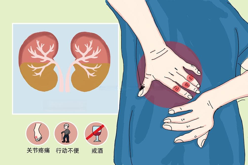 高尿酸知识科普