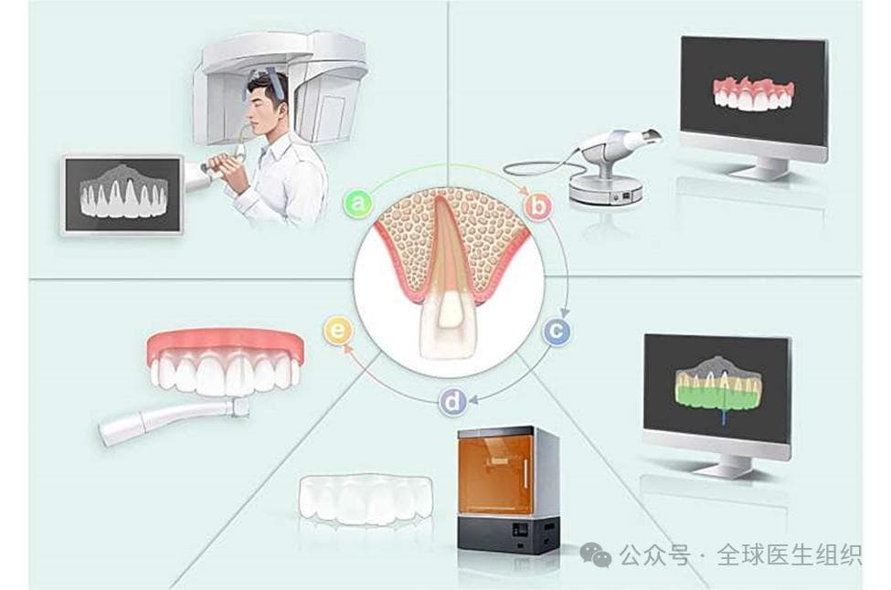 前沿进展|改变根管治疗方法: 精准牙科的兴起