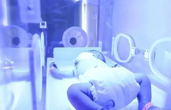 新生儿溶血病您知道多少？