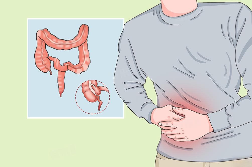 男人右边小腹下面隐隐作痛