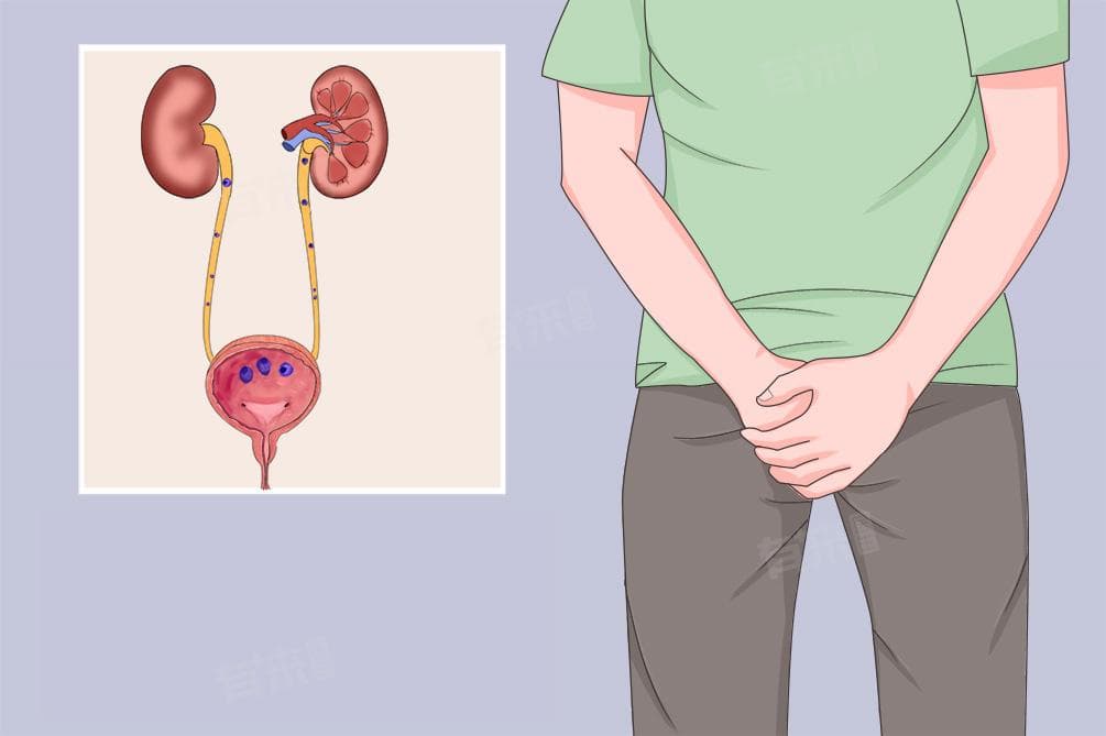 怀疑身体有寄生虫？挂哪个科室最合适？