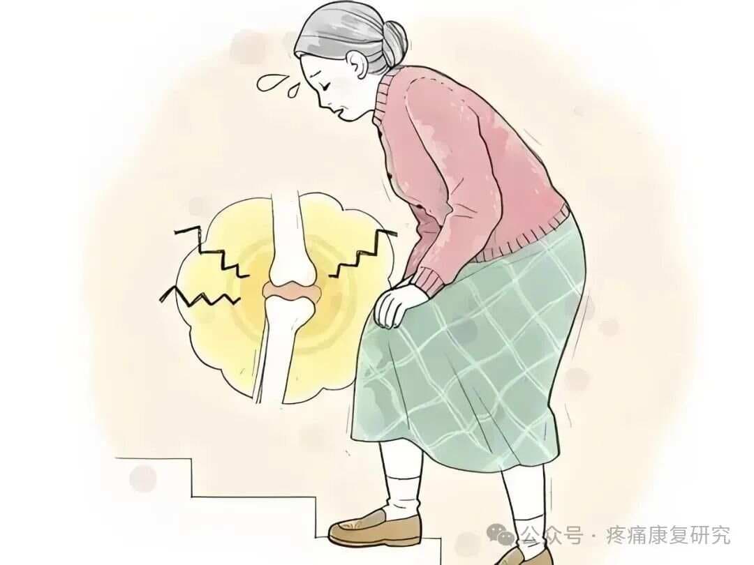膝关节“咔咔响”？出现这些症状一定要重视...