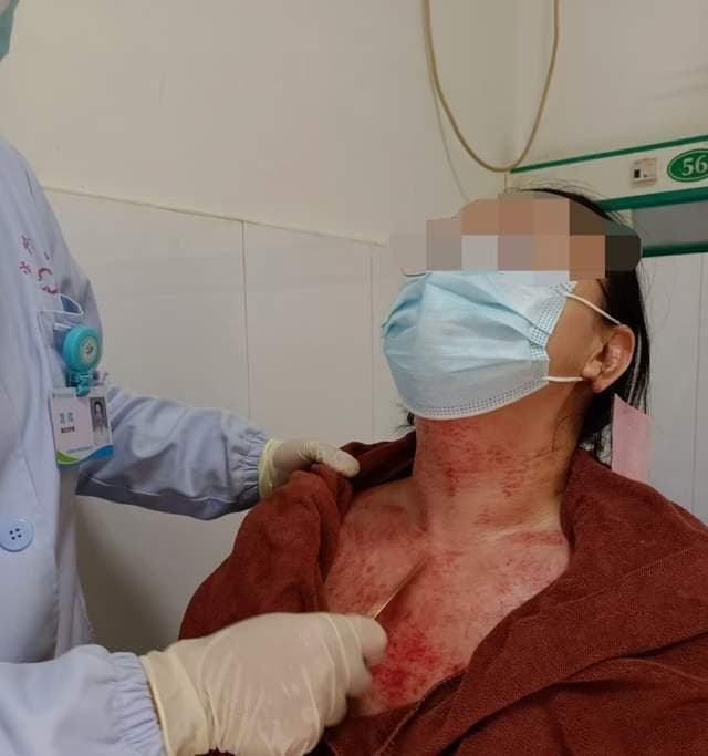 中医四疗法攻克持续性打嗝，专家详解操作要点