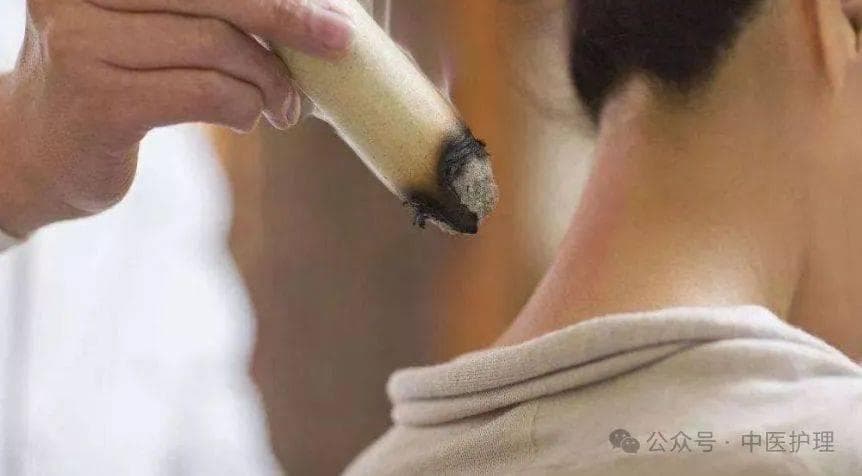 中医适宜技术——为中风病患者带来曙光