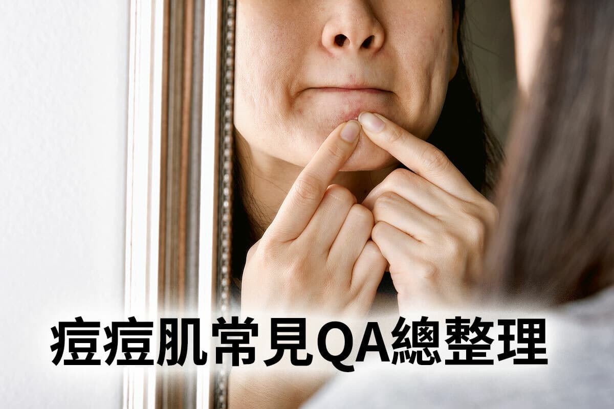 痘痘问题全解析：有效改善青春痘的10个方法