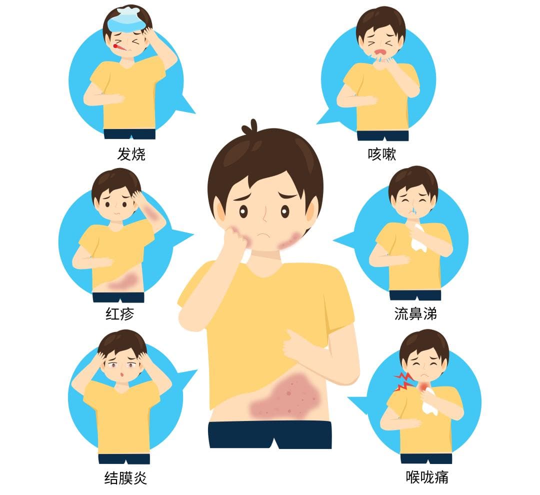 关于麻疹，这些知识您要掌握