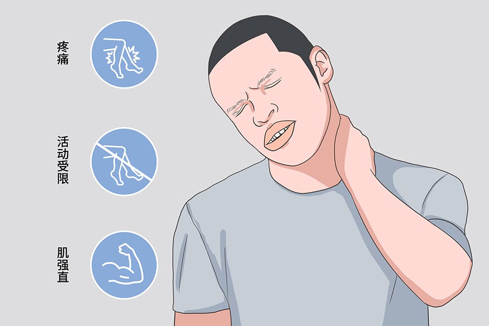 僵人综合征：一种罕见的神经系统疾病