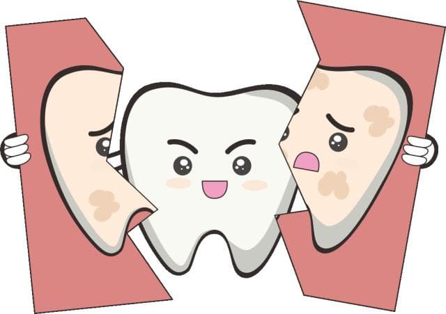洗牙能彻底解决“烟渍牙”吗？
