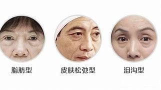 长时间凝视手机屏幕：眼袋与眼科问题的隐忧