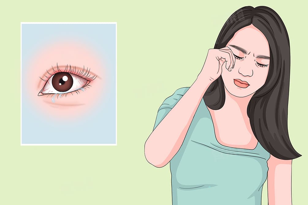 眼睛酸涩睁不开眼总想闭着眼睛怎么办