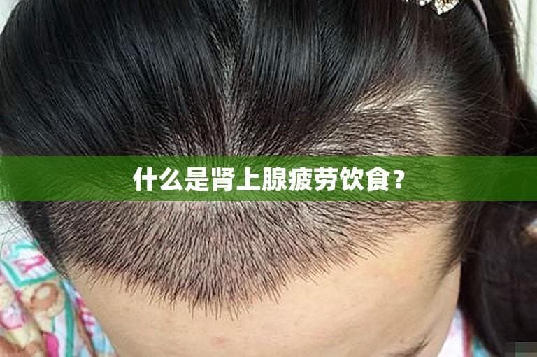 什么是肾上腺疲劳饮食？