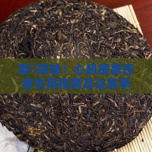 心肌梗塞患者饮品指南：这些饮品能喝吗？