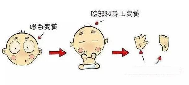 宝宝出黄疸了怎么办？这种情况需尽快就医！