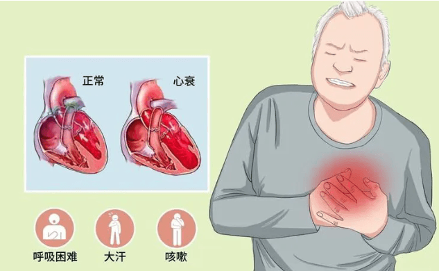深入了解心衰，科学预防与治疗，共筑心脏健康防线