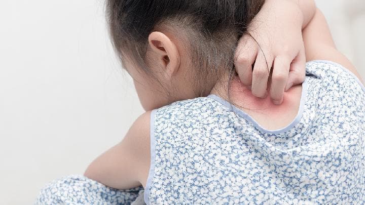 胆碱能性荨麻疹的治疗方法有哪些？