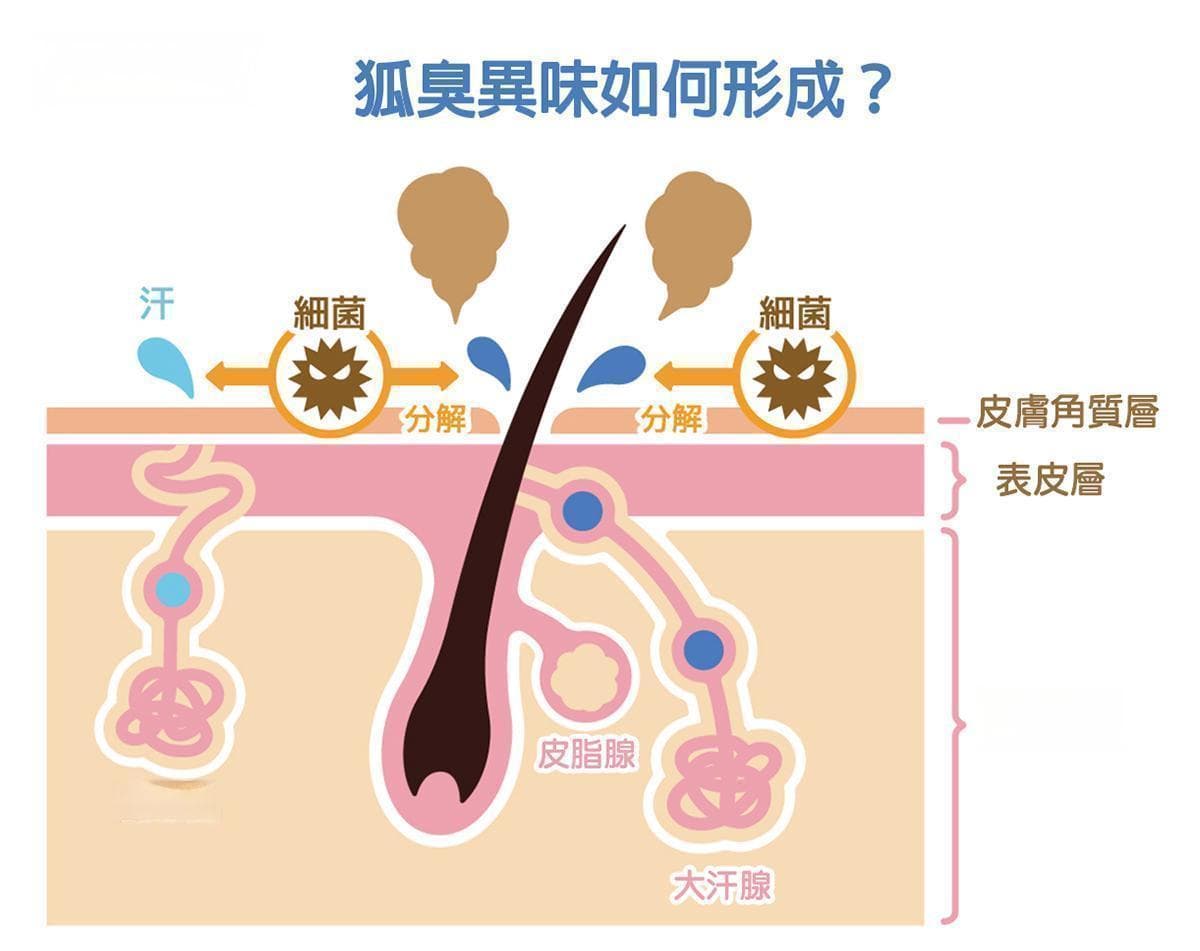 职场狐臭自救指南：从日常护理到根治方案
