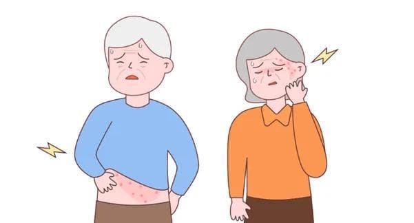 带状疱疹再上热搜！疼痛科专家教您不必谈“蛇”色变