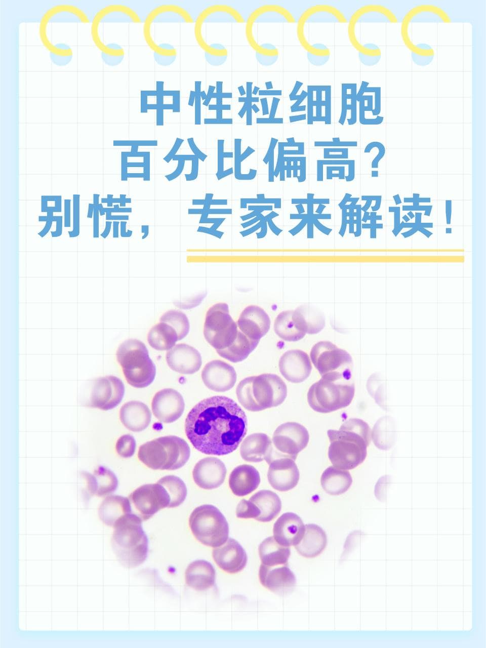 中性粒细胞百分比偏高？和这6个常见原因有关