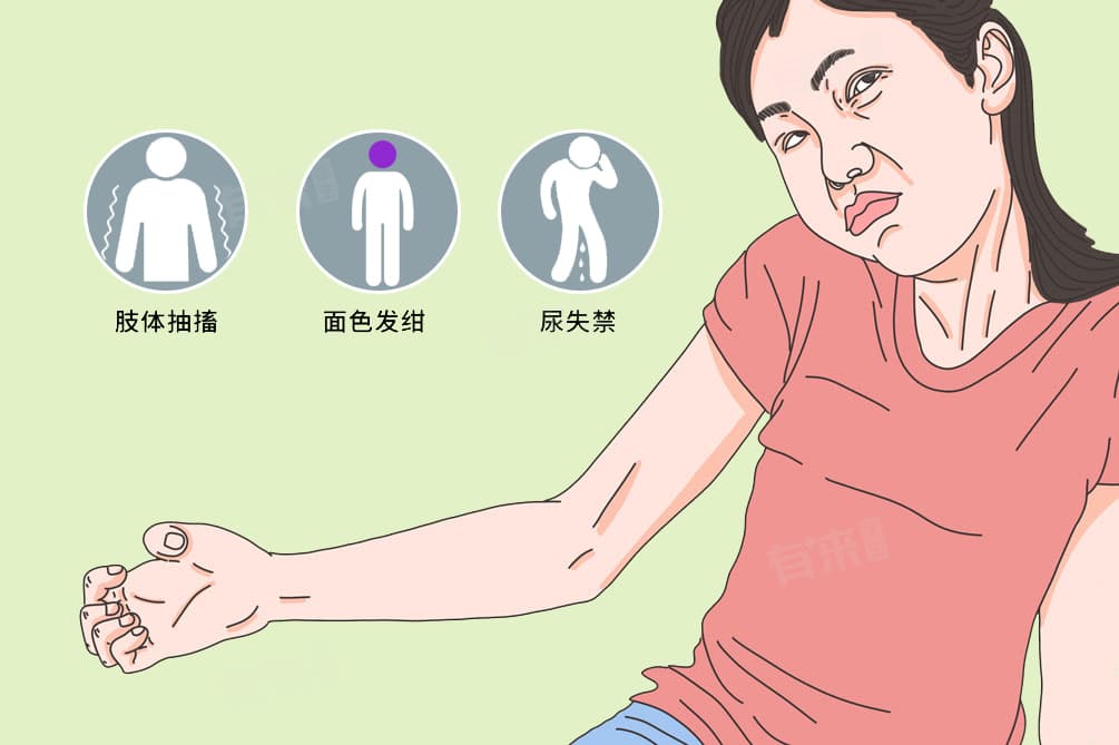 儿童癫痫早期症状及日常注意事项