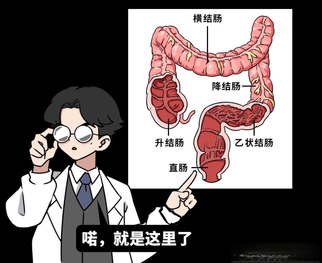 胃肠外科常见病及直肠癌治疗选择