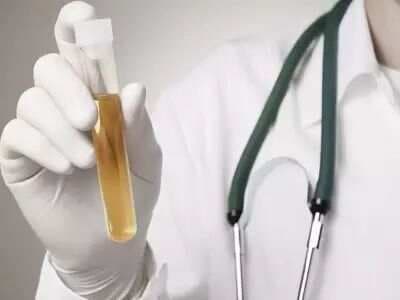 高血压患者：如何在尿液检查中发现肾损害