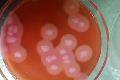 蜡样芽孢杆菌：从有害细菌到益生菌的双重身份