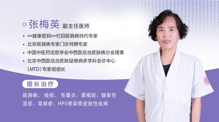名医张梅英主任:银屑病初期症状识别,早治早安心