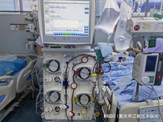 重大突破！两江新区中医院血浆置换助力多脏器衰竭患者重生！