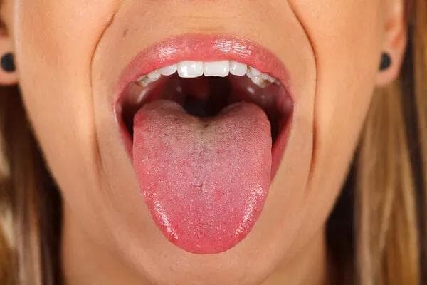 舌头两边向内凹陷的可能原因及应对方法