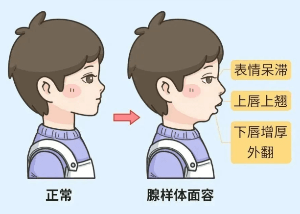 孩子身上自带的“健脾穴”，睡前按一按，健脾胃、强肺气，消灭鼻炎、腺样体肥大！