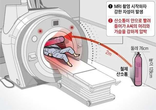 磁共振成像安全指南与注意事项