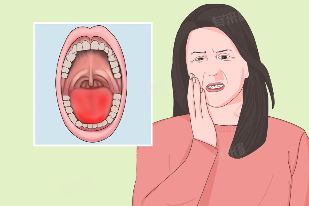 舌头上面有红色的小点点怎么办？