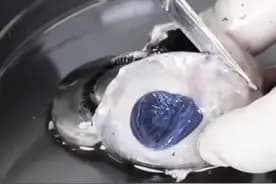 眼的解剖结构和生理功能