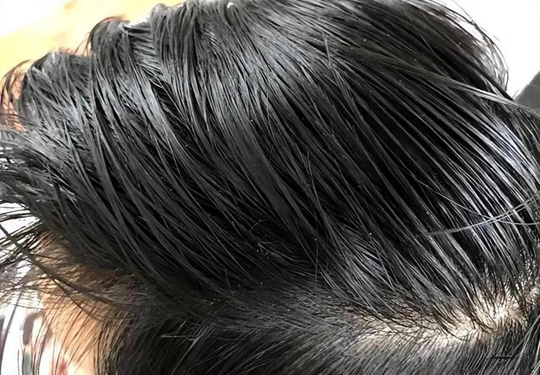 硫磺皂的六大生活妙用，2元小物竟有如此多用途