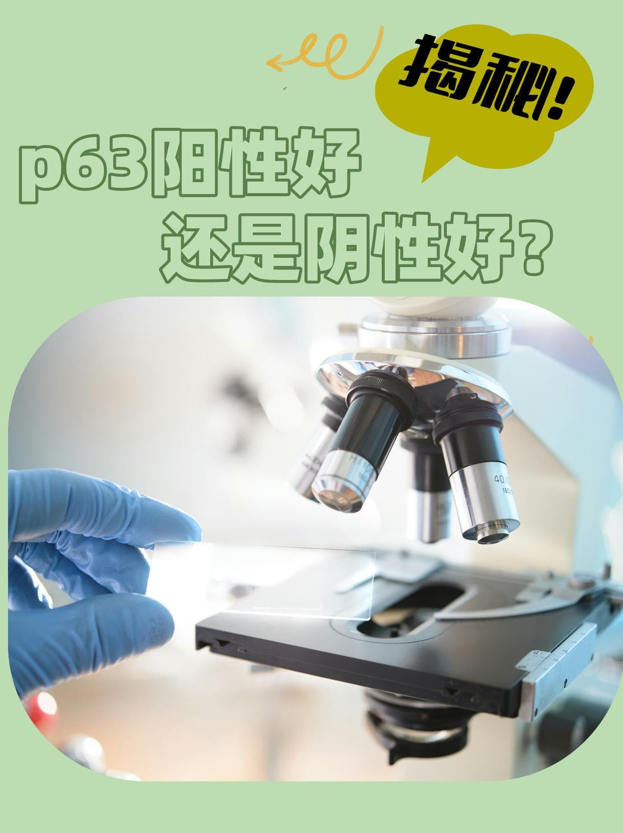 揭秘：p63阳性好还是阴性好？
