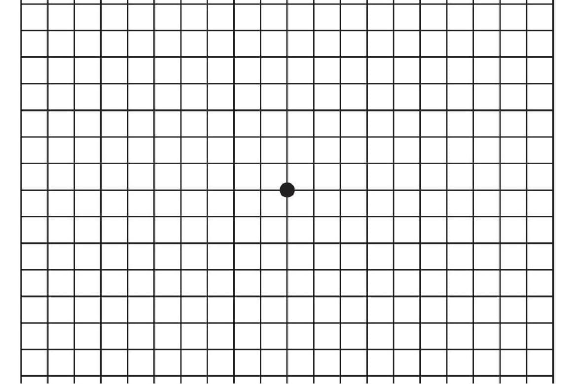 检查黄斑病变的格子图