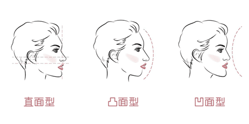 什么样属于轻度地包天？来看临床表现+病因分析+治疗方案